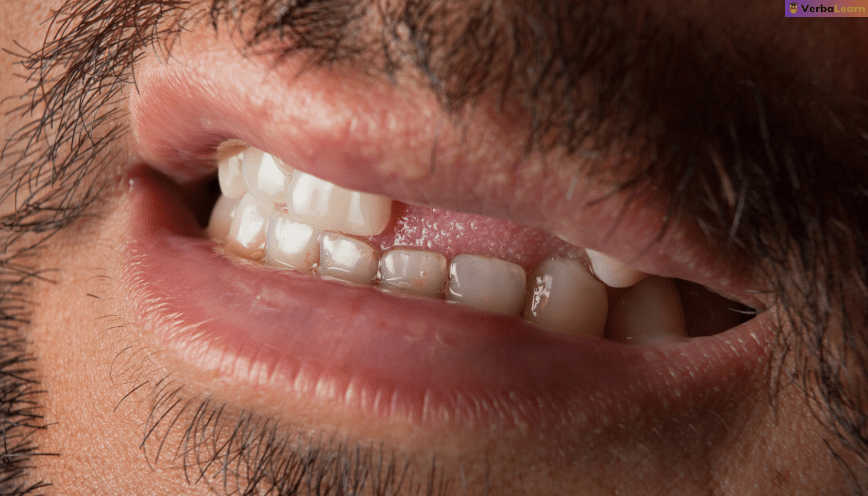 Mơ thấy rụng răng hàm trên