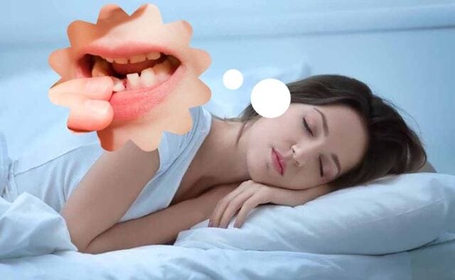 Tham khảo con số may mắn khi chiêm bao thấy răng cửa bị gãy