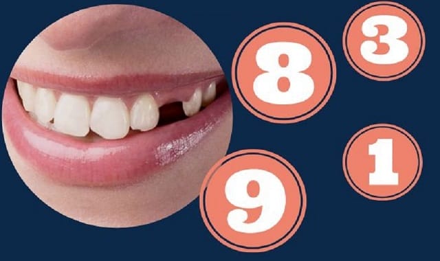 Bỏ túi những con số chuẩn xác khi mơ thấy nhổ răng