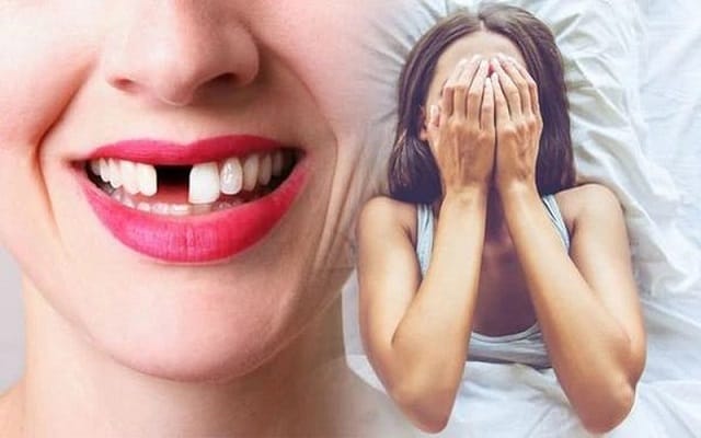 Luận giải giấc mơ thấy bị gãy răng cửa