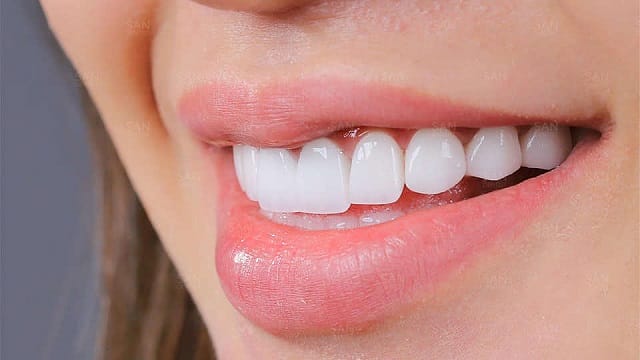 Mơ mọc răng và những con số đặc biệt may mắn