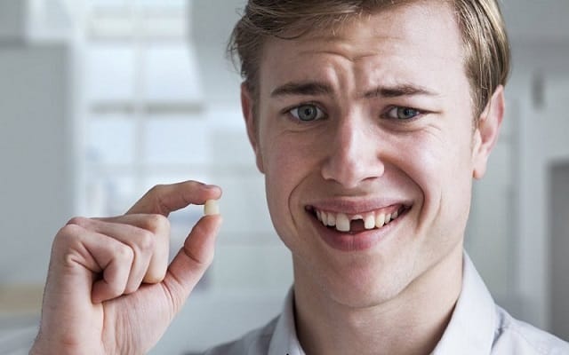 Mơ thấy bị gãy răng cửa nên chốt số nào