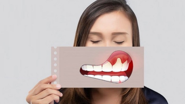 Mơ thấy chảy máu răng - Lời cảnh báo quan trọng từ tâm linh?