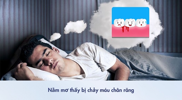 Thông điệp cho giấc mơ chảy máu răng là gì?