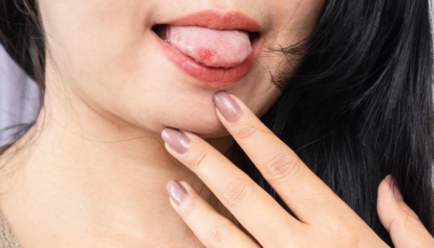Đột nhiên cắn vào lưỡi trong lúc ngủ ban đêm