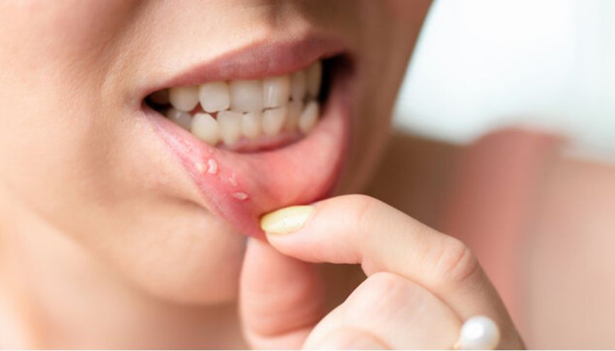 Cắn vào môi dưới trong lúc đang nói chuyện
