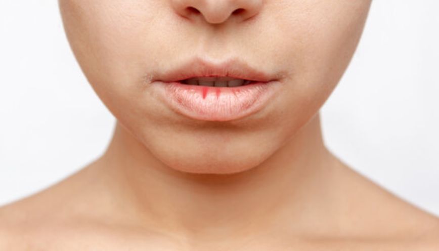 Cắn vào môi nhiều lần liên tiếp tại cùng một thời điểm