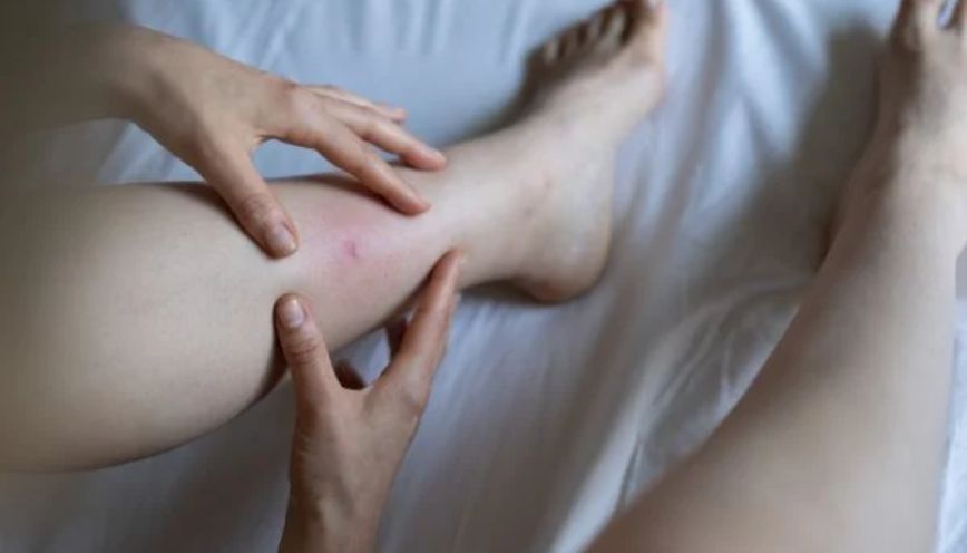 Bị gián cắn giật mình tỉnh giấc